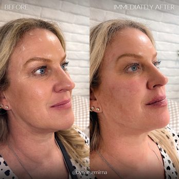 Trusted Aesthetics - Medical Spas Near Me - Corona, California Trusted Aesthetics - Medical Spas Near Me - Corona, California