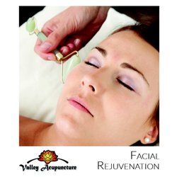 Valley Acupuncture
