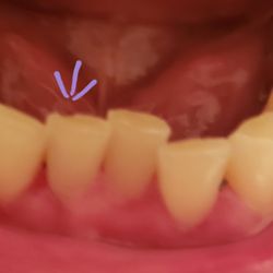 Richard Stacey, DDS - Stacey Family Dental