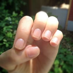 Day 2 of my shellac manicure by Hoang.