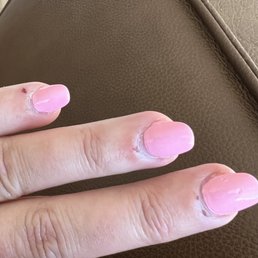 if you want longer then this length--- $5 more!!! (Hands healing after getting a full set of acrylic nails at lily nails SJC.) if you want longer then this length--- $5 more!!! (Hands healing after getting a full set of acrylic nails at lily nails SJC.)