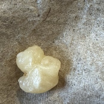McDonald's - Tooth or Crack !! who knows - Fast Food Near Me - Norfolk, Virginia McDonald's - Tooth or Crack !! who knows - Fast Food Near Me - Norfolk, Virginia