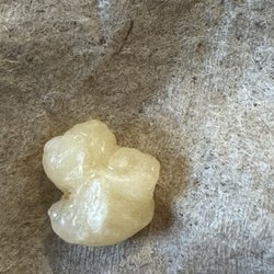 McDonald's - Tooth or Crack !! who knows