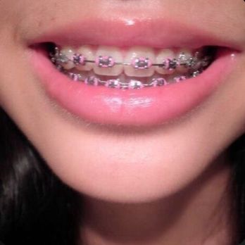 Dr Maritza De Jesus - My daughter teeth straight - Orthodontists Near Me - Orlando, Florida Dr Maritza De Jesus - My daughter teeth straight - Orthodontists Near Me - Orlando, Florida