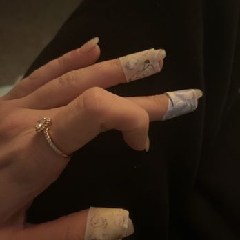 Sunny Top Nail Salon - I have to wear band-Aids because I'm in pain after my visit - Nail Salons Near Me - Staten Island, New York Sunny Top Nail Salon - I have to wear band-Aids because I'm in pain after my visit - Nail Salons Near Me - Staten Island, New York