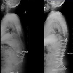 Apex Spine and Neurosurgery