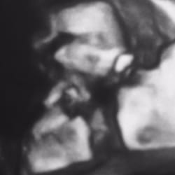 Show & Tell 3d/4d Ultrasound Studio - Our precious new baby at 15 weeks