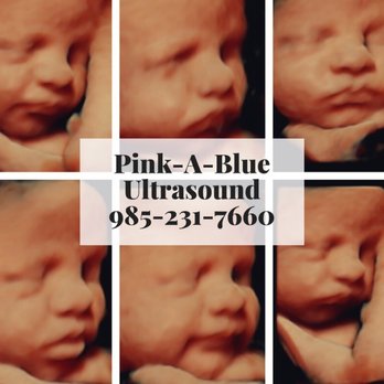 Pink-A-Blue Ultrasound - Diagnostic Imaging Near Me - Mandeville, Louisiana Pink-A-Blue Ultrasound - Diagnostic Imaging Near Me - Mandeville, Louisiana