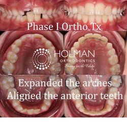 Holman Orthodontics - Come see us for a Free Consultation! 
801-278-2819