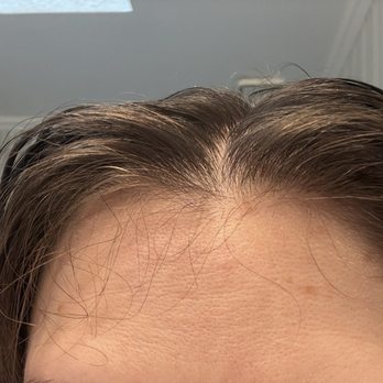 Et Jolie Aveda Salon & Spa - Short hairs at the top of the head because of the insane way she tried to do face framing layers - Hair Salons Near Me - Reston, Virginia Et Jolie Aveda Salon & Spa - Short hairs at the top of the head because of the insane way she tried to do face framing layers - Hair Salons Near Me - Reston, Virginia