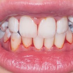 Family Dental of Thornton