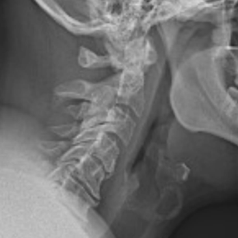 UF Health North - Damaged my neck. - Emergency Rooms Near Me - Jacksonville, Florida UF Health North - Damaged my neck. - Emergency Rooms Near Me - Jacksonville, Florida