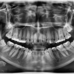 Diamond Bar Dental Imaging Center
