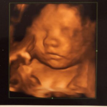 Baby Bump Studios - 4D ultrasound - Diagnostic Imaging Near Me - Ontario, California Baby Bump Studios - 4D ultrasound - Diagnostic Imaging Near Me - Ontario, California