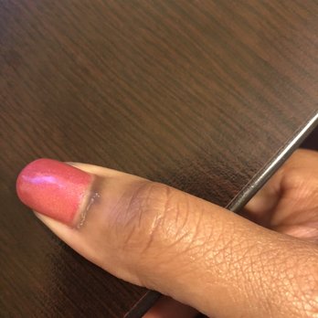 Nail Shack Salon & Spa - My thumb is by far the WORST result of the cuticle pulling. - Nail Salons Near Me - Atlanta, Georgia Nail Shack Salon & Spa - My thumb is by far the WORST result of the cuticle pulling. - Nail Salons Near Me - Atlanta, Georgia