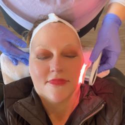 fizz facial bar - LED light therapy