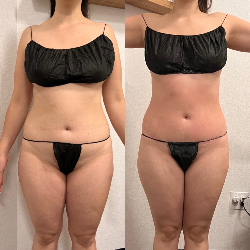 DIVINE AESTHETICS STUDIO Updated October 2024 2086 Newpark Mall, Newark, California Body