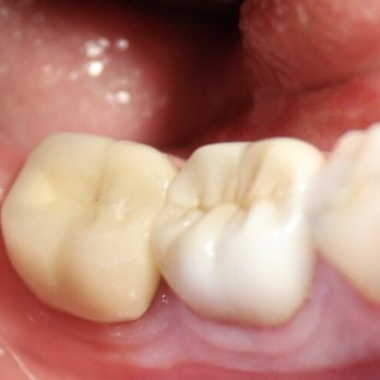 Oualid Tellissi, DMD - Cosmetic Dentists Near Me - Palm Desert, California Oualid Tellissi, DMD - Cosmetic Dentists Near Me - Palm Desert, California