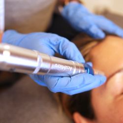 Three Lotus Dragon Acupuncture Wellness Center - Facial rejuvenation using micro-needling painless treatment for youthful beauty