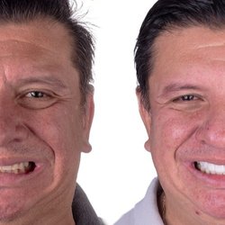 Dewey Dental Group - Notice the joy a smile makeover can bring, and best part, it is only 2 visits away!