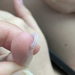 Top Nails - Before