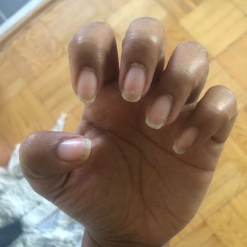 Indo Canada Beauty Salon - Shellac take off + manicure - Hair Removal Near Me - Etobicoke, Ontario Indo Canada Beauty Salon - Shellac take off + manicure - Hair Removal Near Me - Etobicoke, Ontario