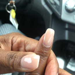 My mom's cracked nail.