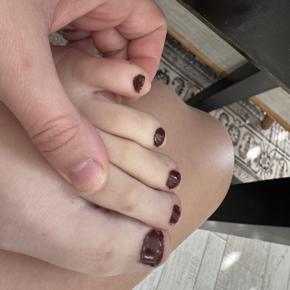 Orchid Nail Spa - Bad pedicure - Nail Salons Near Me - El Paso, Texas Orchid Nail Spa - Bad pedicure - Nail Salons Near Me - El Paso, Texas