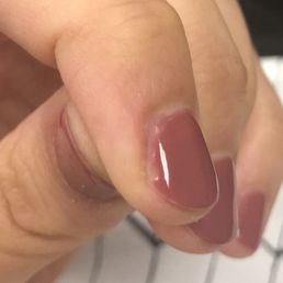 It's been less than a day. It should not look this bad.