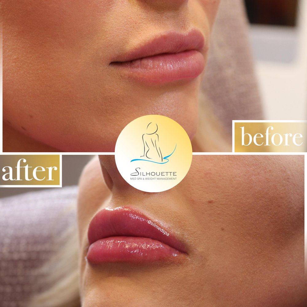 Silhouette Med Spa & Weight Management 45 Photos & 208 Reviews