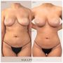 Photo of Squlpt Body Shaping
