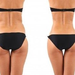 Tigard Body Sculpting & Aesthetics