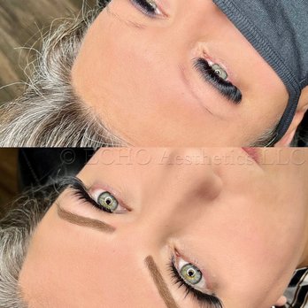 ECHO Med - Before and immediately after perfection appt.! Look how much more youthful and eye popping the right brows can do! - Medical Spas Near Me - Chandler , Arizona