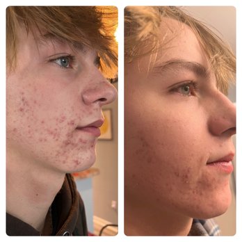 Clarity Dermatology - Dermatologists Near Me - Parker, Colorado Clarity Dermatology - Dermatologists Near Me - Parker, Colorado