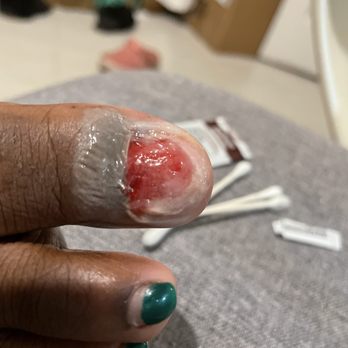 167 Foxy Nails - AFTER MY TOE NAIL REMOVAL VERY PAINFUL ! Please dont go here - Nail Salons Near Me - The Bronx, New York
