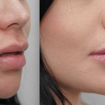 Vladimir Grigoryants, MD - Cosmetic Surgeons Near Me - Glendale, California Vladimir Grigoryants, MD - Cosmetic Surgeons Near Me - Glendale, California