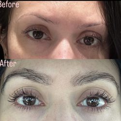 Bosley Hair Restoration & Transplant