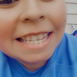 Lake Ridge Orthodontics