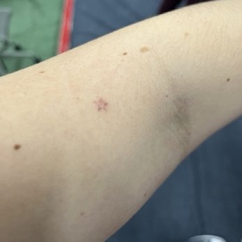 Embassy Tattoo - Poorly done tattoo by Isis - Piercing Near Me - Washington, DC, District of Columbia