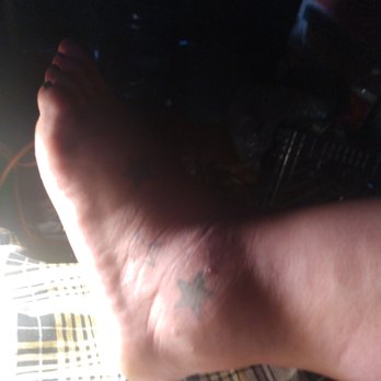 Hotel Nova SFO - Bug bites from last night. My whole ankle is swollen now!!! - Hotels Near Me - South San Francisco, California Hotel Nova SFO - Bug bites from last night. My whole ankle is swollen now!!! - Hotels Near Me - South San Francisco, California