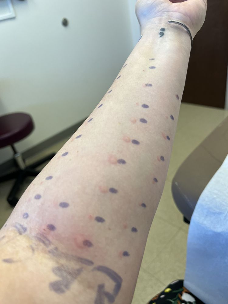 ALLERGY PARTNERS OF THE TRIANGLE Updated September 2024 11 Reviews 100 Parkway Office Ct