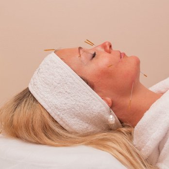 EcoAcupuncture - Cosmetic Acupuncture - Acupuncture Near Me - Plantation, Florida EcoAcupuncture - Cosmetic Acupuncture - Acupuncture Near Me - Plantation, Florida