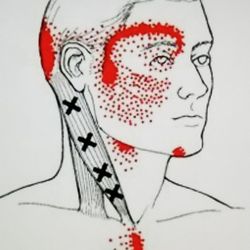 A Nu Feel'N Myofascial Pain Center