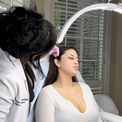 Medspa Nirvana by Noel - Non Surgical Face lift with Barbed PDO threads