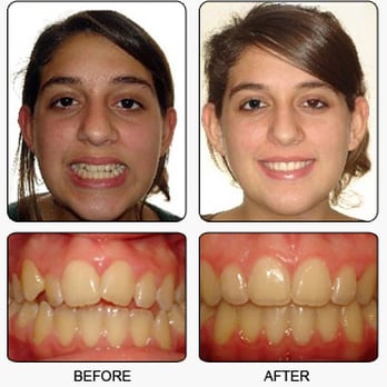 Greenberg Orthodontics & TMJ - Oral Surgeons Near Me - Altadena, California Greenberg Orthodontics & TMJ - Oral Surgeons Near Me - Altadena, California