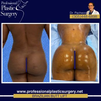 Professional Plastic Surgery - Brazilian Butt Lift - Cosmetic Surgeons Near Me - Miami, Florida Professional Plastic Surgery - Brazilian Butt Lift - Cosmetic Surgeons Near Me - Miami, Florida