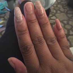 Broken nails