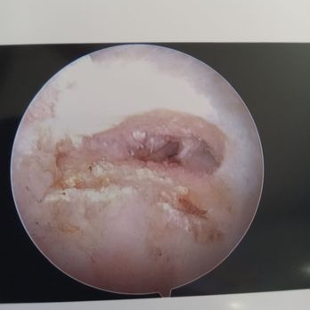 Adventist Health Bakersfield - Inside my shoulder before surgery. - Medical Centers Near Me - Bakersfield, California Adventist Health Bakersfield - Inside my shoulder before surgery. - Medical Centers Near Me - Bakersfield, California