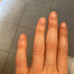 Beauty Nails - Broken nails. Cuts near cuticle.