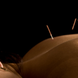 Stefanie Cotter Acupuncture